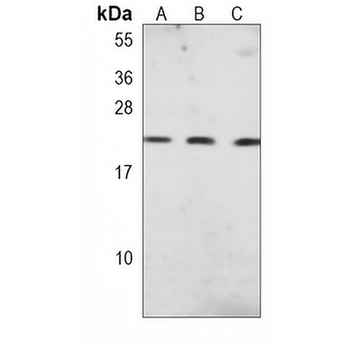 CD81 Mouse Monoclonal Antibody(C3832)