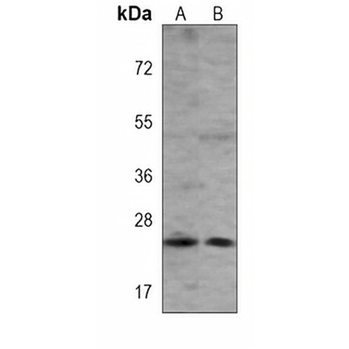 RAB8A Mouse Monoclonal Antibody(C3837)
