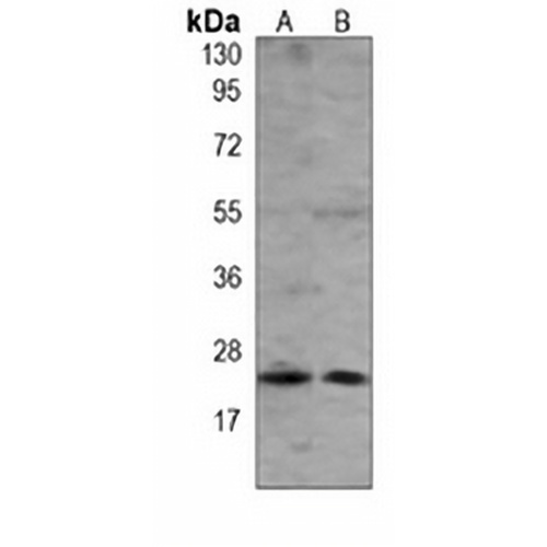 RAB5B Mouse Monoclonal Antibody(C3838)