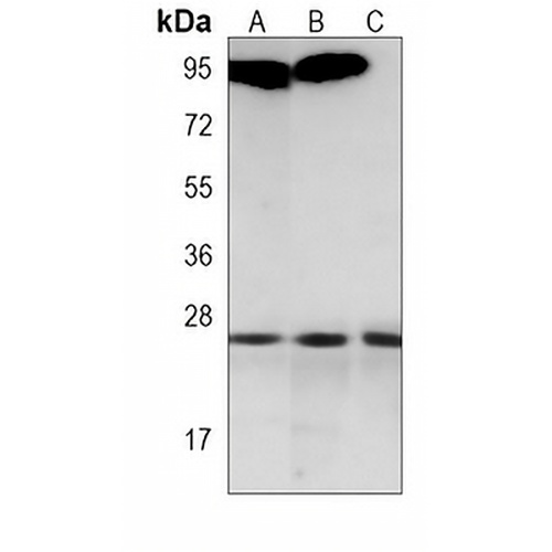 RAB14 Mouse Monoclonal Antibody(C3839)