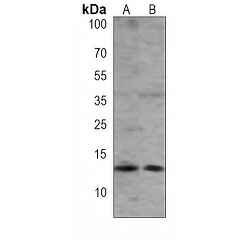 Beta 2 Microglobulin Mouse Monoclonal Antibody(C3841)