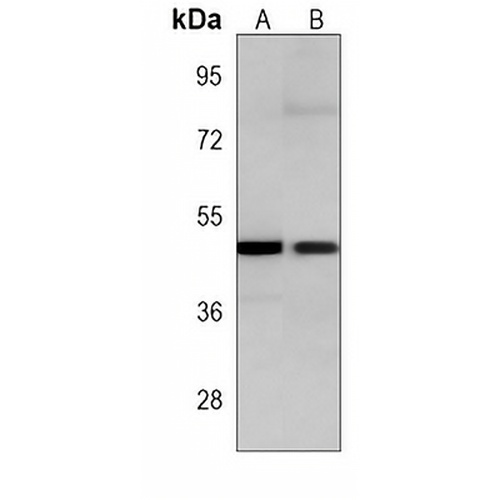 TGF beta 2 Mouse Monoclonal Antibody(C3842)
