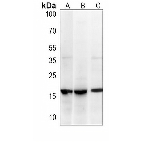 SUMO2 Mouse Monoclonal Antibody(C3843)