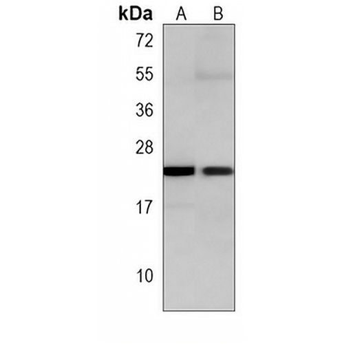 RRAS2 Mouse Monoclonal Antibody(C3844)