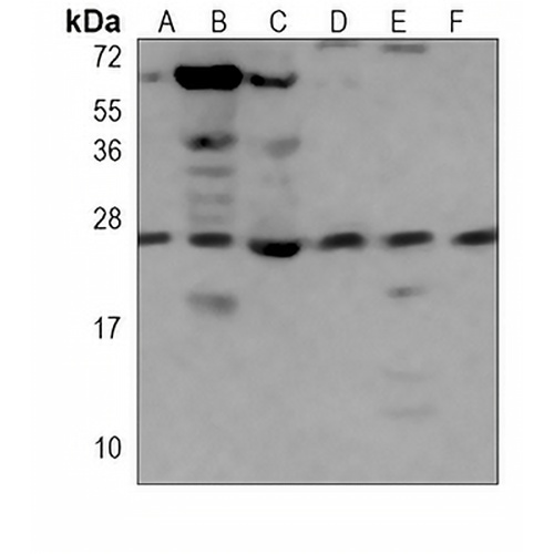 RAB11A Mouse Monoclonal Antibody(C3845)
