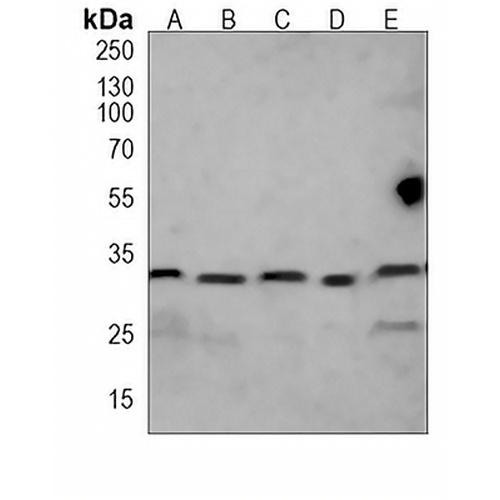 RPS6 Mouse Monoclonal Antibody(C3846)