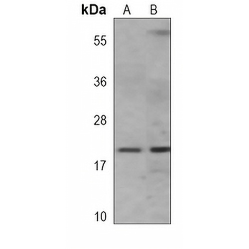 VILIP-1 Mouse Monoclonal Antibody(C3847)