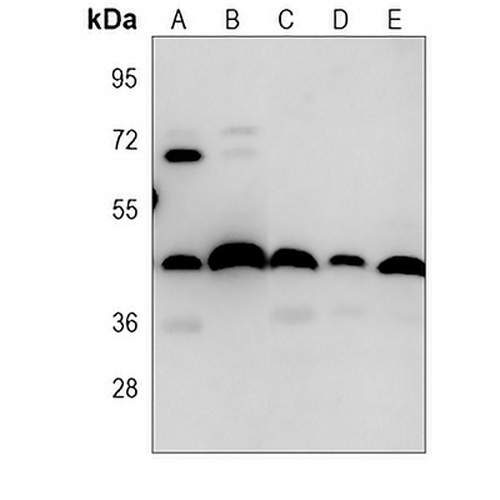 Alpha-actin-1 Mouse Monoclonal Antibody(C3854)