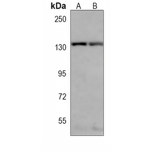 RBM6 Mouse Monoclonal Antibody(C3858)