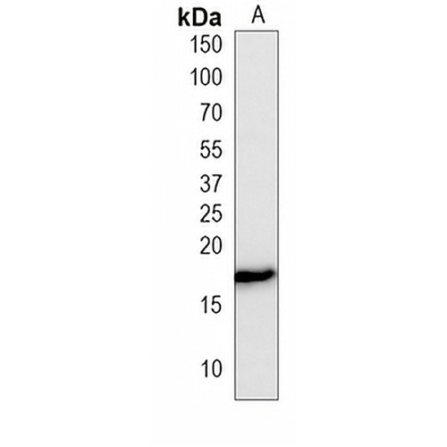 Histone H3 (Phospho-S10) Mouse Monoclonal Antibody(C3859)