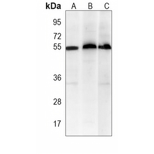 XIAP Mouse Monoclonal Antibody(C3860)