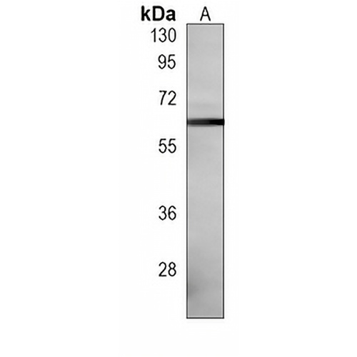 MDM2 Mouse Monoclonal Antibody(C3863)