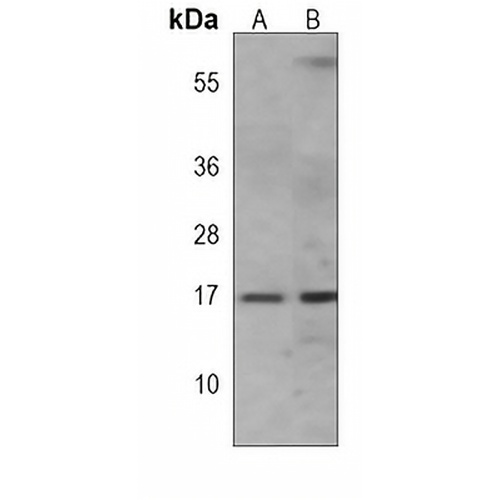 IFITM3 Mouse Monoclonal Antibody(C3865)