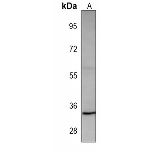 MC1 Receptor Mouse Monoclonal Antibody(C3866)