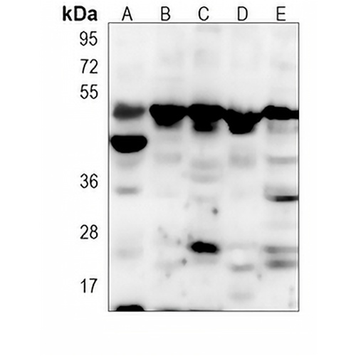 MKK1 Mouse Monoclonal Antibody(C3869)