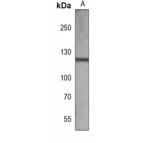 Focal Adhesion Kinase Mouse Monoclonal Antibody(C3874)