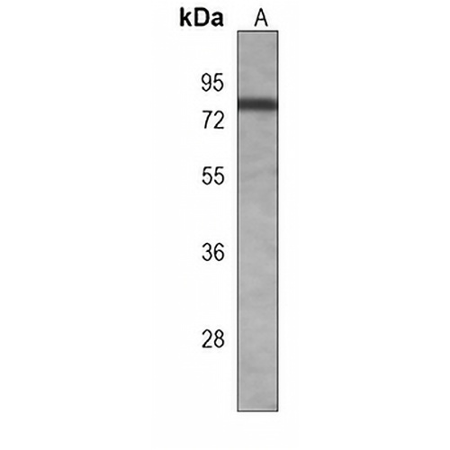 BTK Mouse Monoclonal Antibody(C3875)