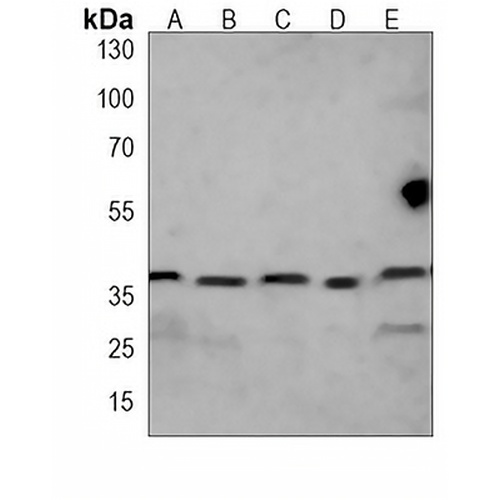 RAD51A Mouse Monoclonal Antibody(C3876)
