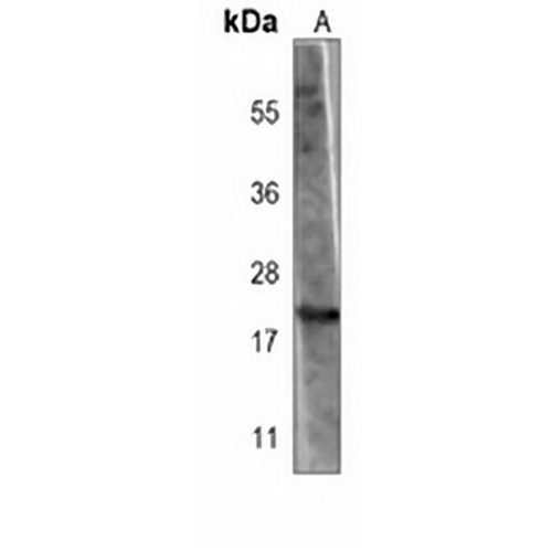 BAX Mouse Monoclonal Antibody(C3878)