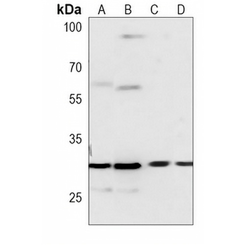 BCLX Mouse Monoclonal Antibody(C3879)