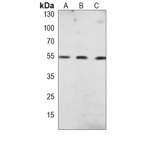 PPAR alpha Mouse Monoclonal Antibody(C3880)