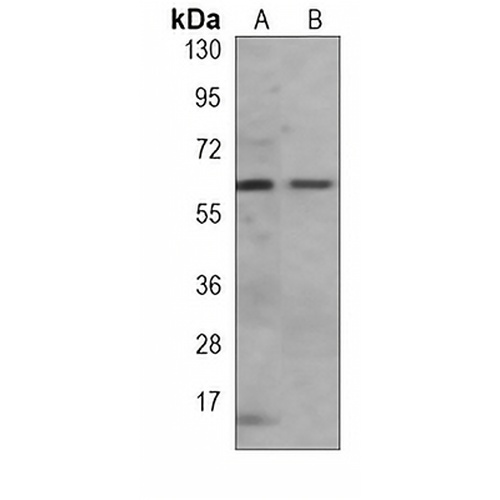 p62 Mouse Monoclonal Antibody(C3889)