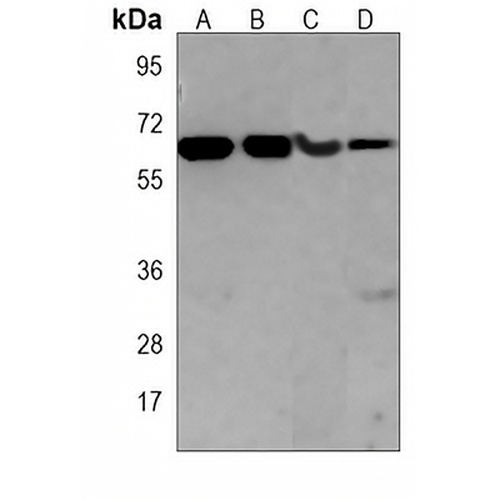 CaMK2 beta Mouse Monoclonal Antibody(C3894)