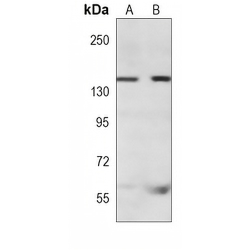 KANK1 Mouse Monoclonal Antibody(C3901)