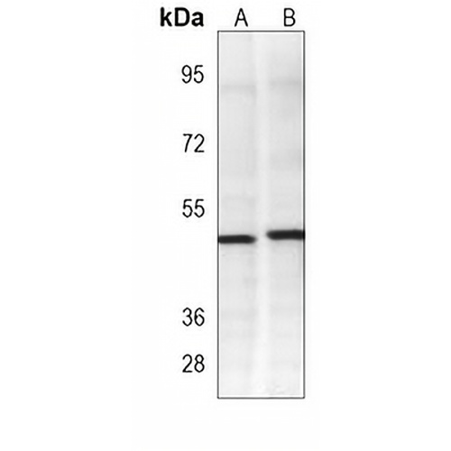 PDK2 Mouse Monoclonal Antibody(C3906)