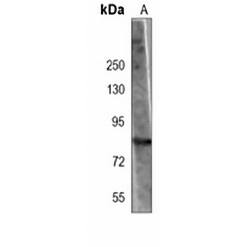 RSK1 Mouse Monoclonal Antibody(C3907)