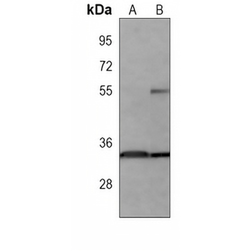 HUR Mouse Monoclonal Antibody(C3908)