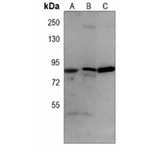 EZH2 Mouse Monoclonal Antibody(C3910)
