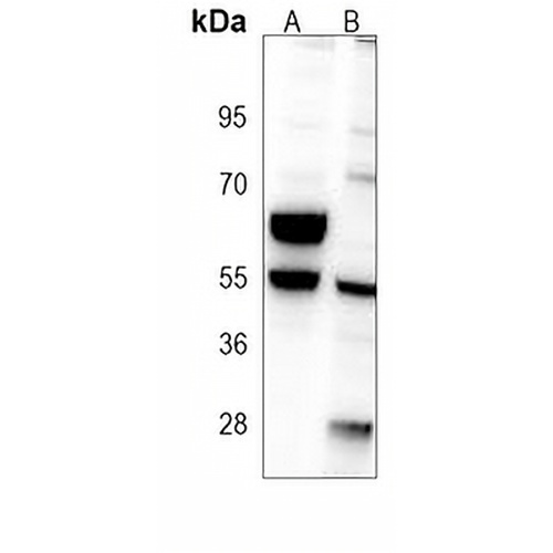 CRMP2 Mouse Monoclonal Antibody(C3913)