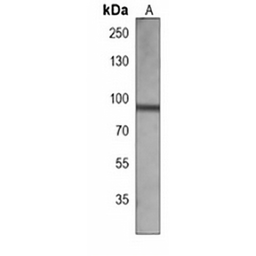 TRK B Mouse Monoclonal Antibody(C3915)