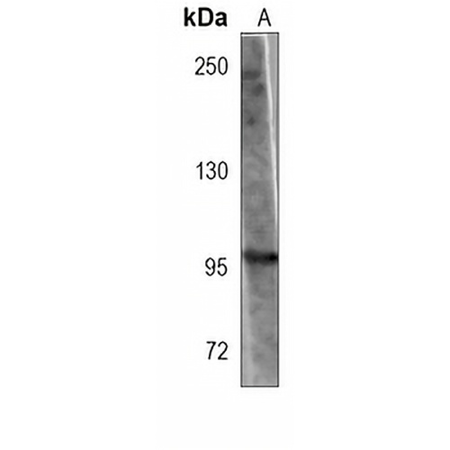 CD167b Mouse Monoclonal Antibody(C3919)