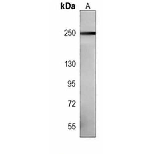 LRRK2 Mouse Monoclonal Antibody(C3923)