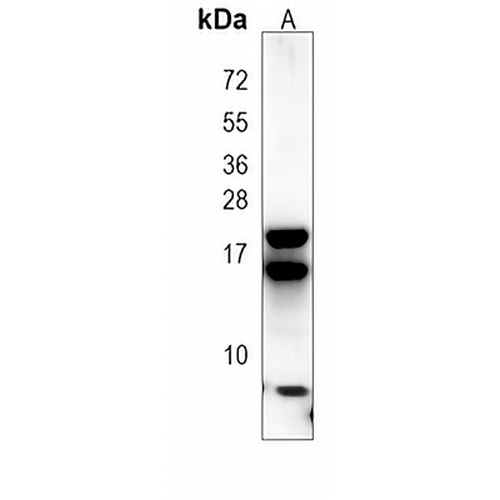 REG3 gamma Mouse Monoclonal Antibody(C3933)