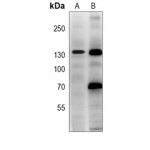 TRK C Mouse Monoclonal Antibody(C3934)