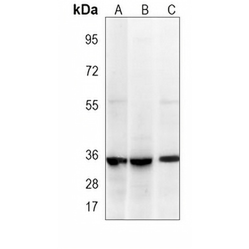 LIN28B Mouse Monoclonal Antibody(C3936)