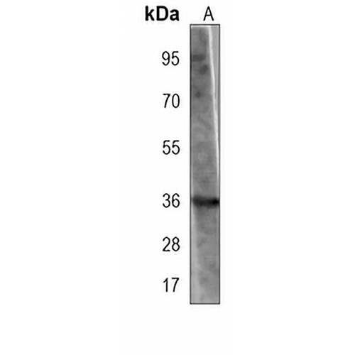 MYO18B Mouse Monoclonal Antibody(C3940)
