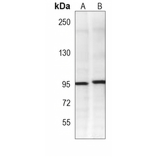 HACE1 Mouse Monoclonal Antibody(C3942)