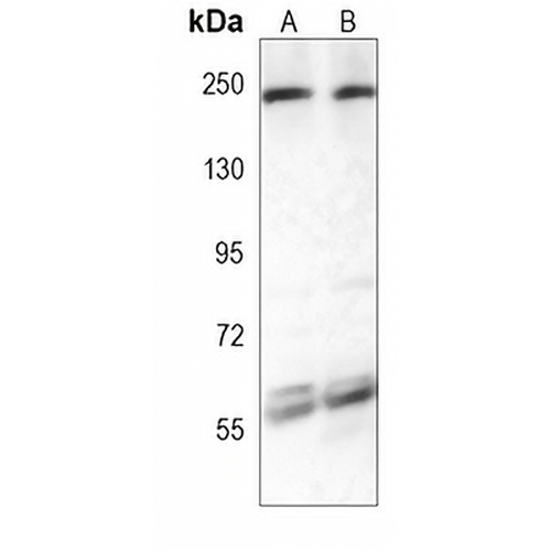 XRN1 Mouse Monoclonal Antibody(C3943)