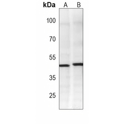 CDK20 Mouse Monoclonal Antibody(C3944)