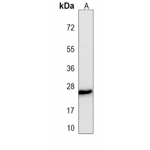 MLL3 Mouse Monoclonal Antibody(C3950)