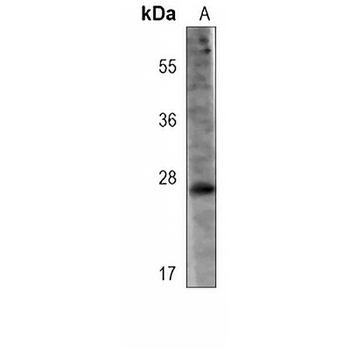 LYPD6B Mouse Monoclonal Antibody(C3952)