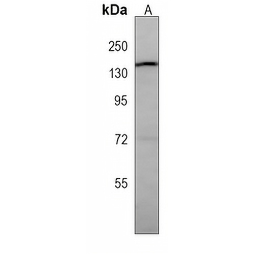 TSC1 Mouse Monoclonal Antibody(C3960)