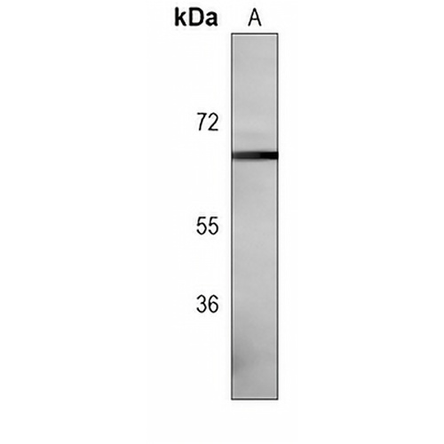 DYRK2 Mouse Monoclonal Antibody(C3961)