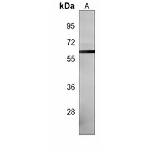 Estrogen Receptor beta Mouse Monoclonal Antibody(C3962)