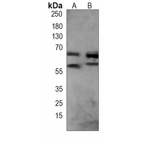 FUBP3 Mouse Monoclonal Antibody(C3972)
