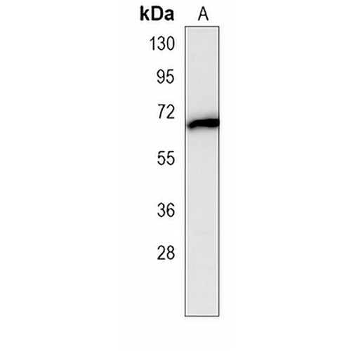 CaMKK beta Mouse Monoclonal Antibody(C3976)